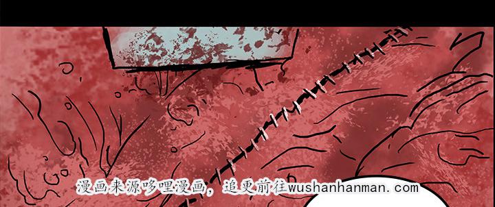 医院的诅咒韩漫全集-15_再次手术无删减无遮挡章节图片 