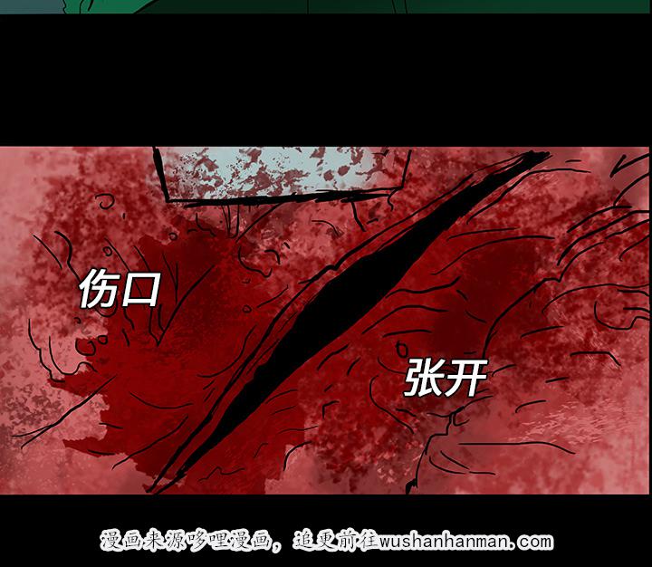 医院的诅咒韩漫全集-15_再次手术无删减无遮挡章节图片 