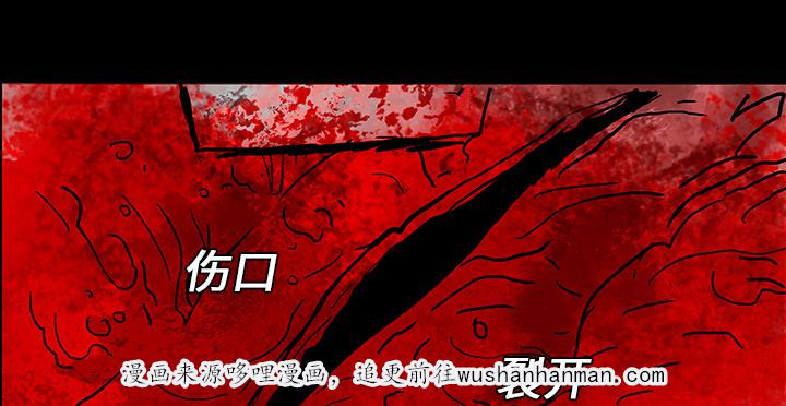 医院的诅咒韩漫全集-16_手术顺利无删减无遮挡章节图片 