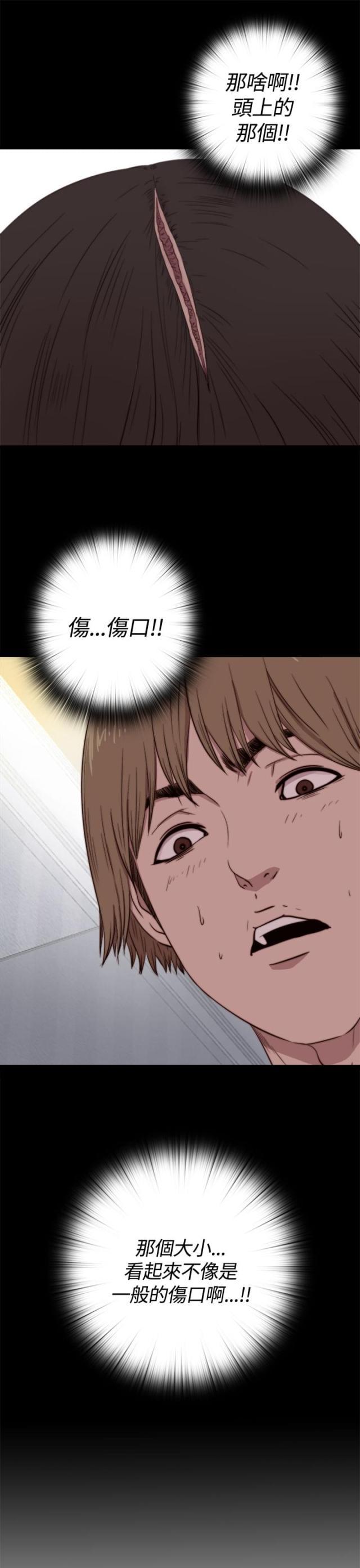 对学生会长的忠告漫画韩漫全集-第10话 不一般的伤口无删减无遮挡章节图片 