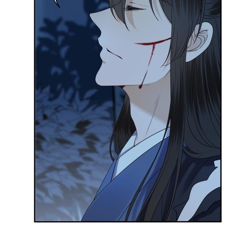 傲娇王爷太难追韩漫全集-第125话 我能把他的手接上无删减无遮挡章节图片 