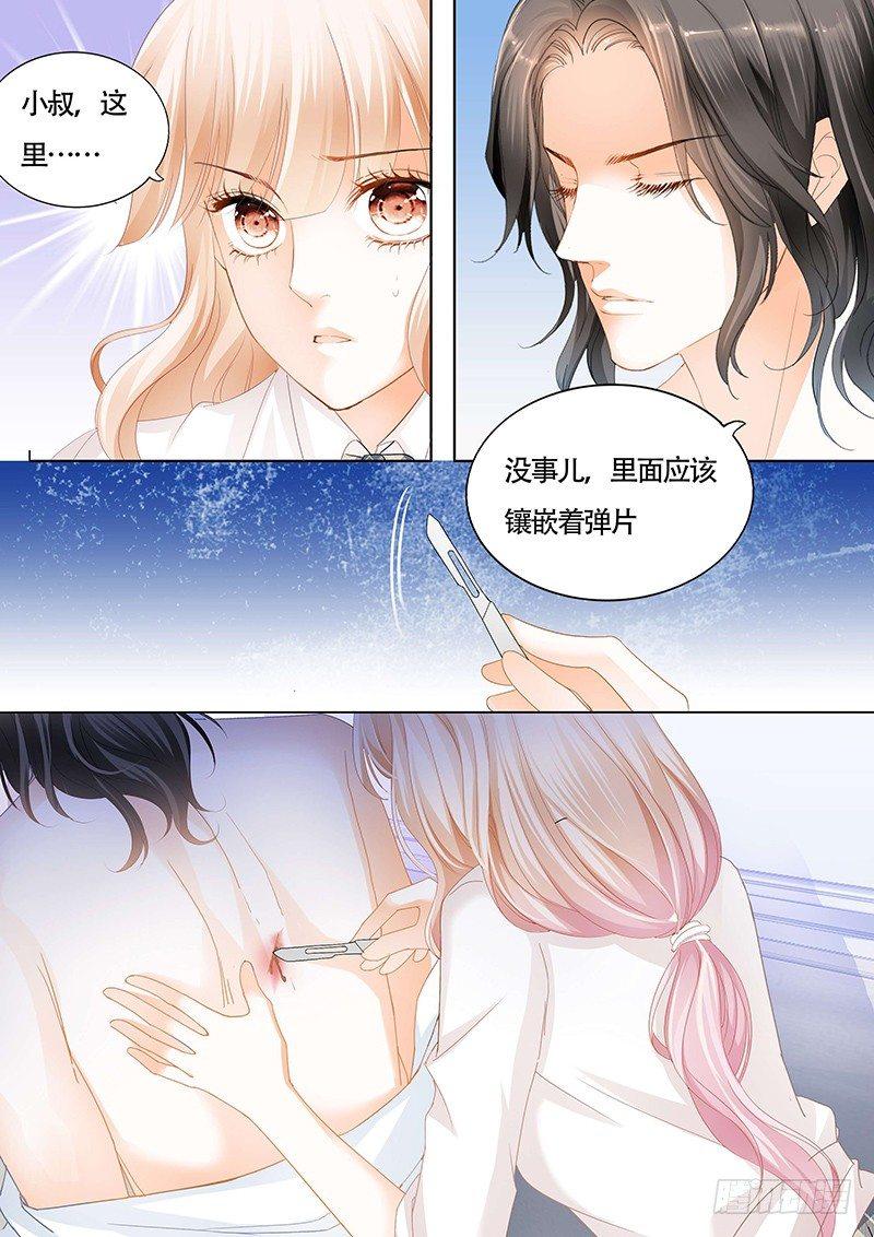 霸道小叔，请轻撩！韩漫全集-为小叔疗伤无删减无遮挡章节图片 