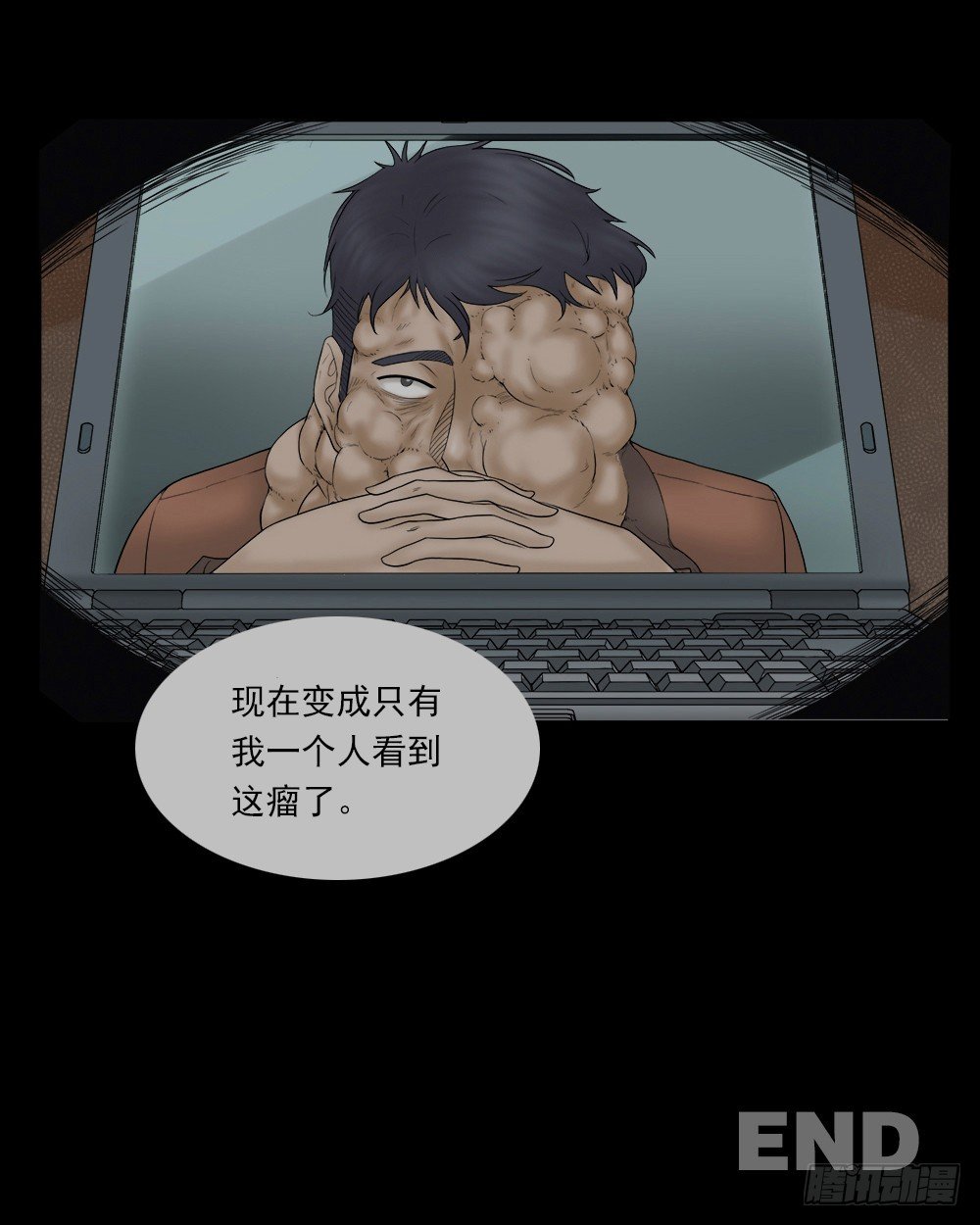 怪奇笔记韩漫全集-奇异的瘤无删减无遮挡章节图片 
