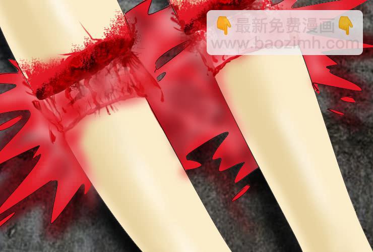 女屌丝的爱情韩漫全集-141断腿女传说（一）无删减无遮挡章节图片 