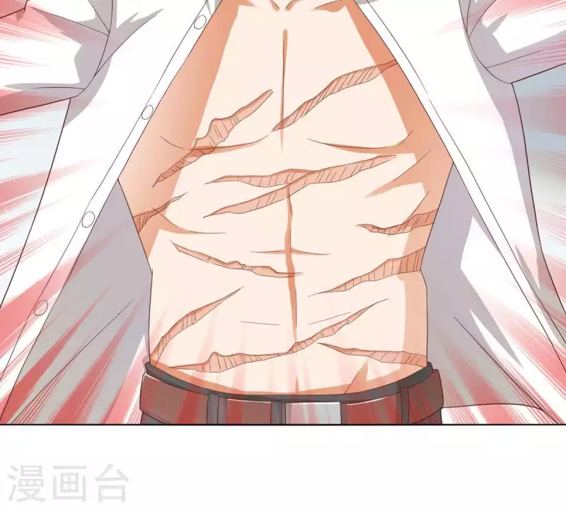贫王韩漫全集-第266话 蠢方法无删减无遮挡章节图片 