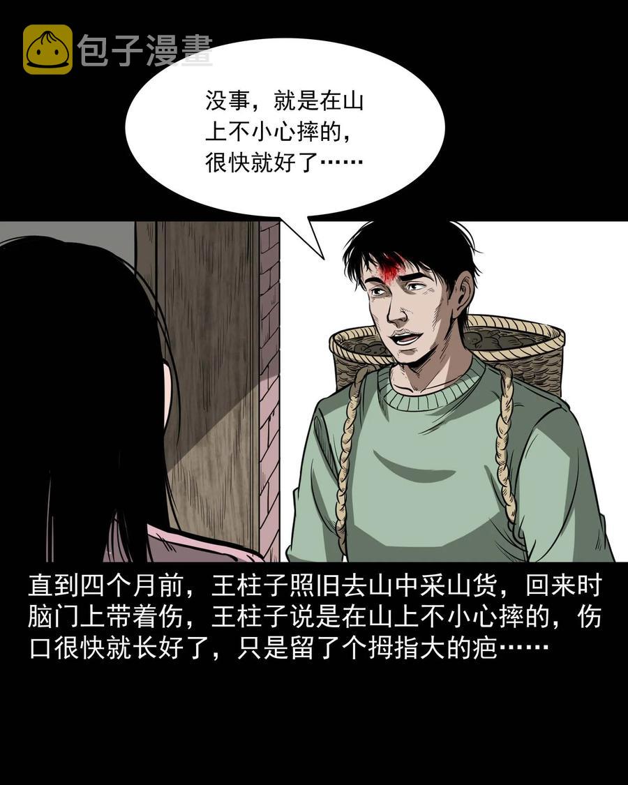 三老爷惊奇手札韩漫全集-313 疯病无删减无遮挡章节图片 