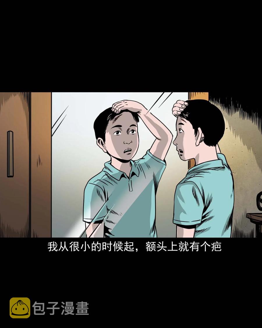 三老爷惊奇手札韩漫全集-335 额头上的疤无删减无遮挡章节图片 
