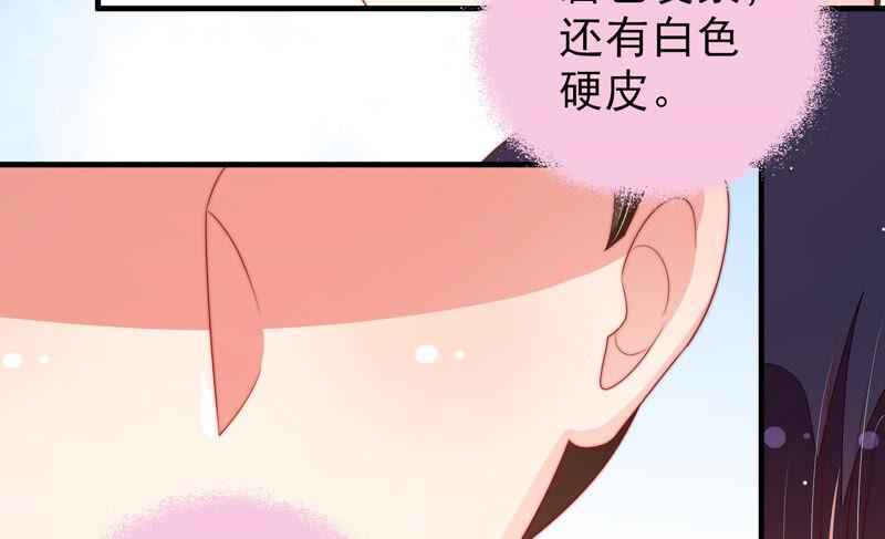 少帅每天都在吃醋韩漫全集-第184话 毒已入骨无删减无遮挡章节图片 