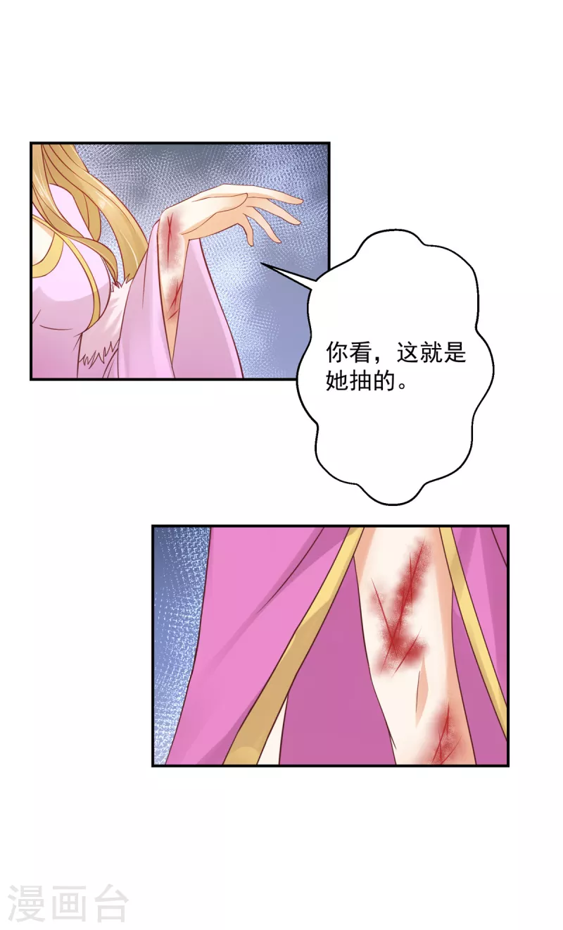 神偷王妃：我家王爷惹不起韩漫全集-第57话 你最好祈祷她没事！无删减无遮挡章节图片 