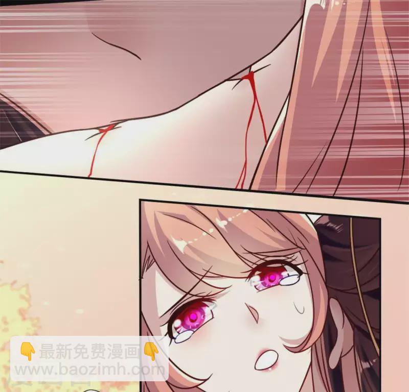 我的血族大人韩漫全集-第32话 火焰的滋味无删减无遮挡章节图片 