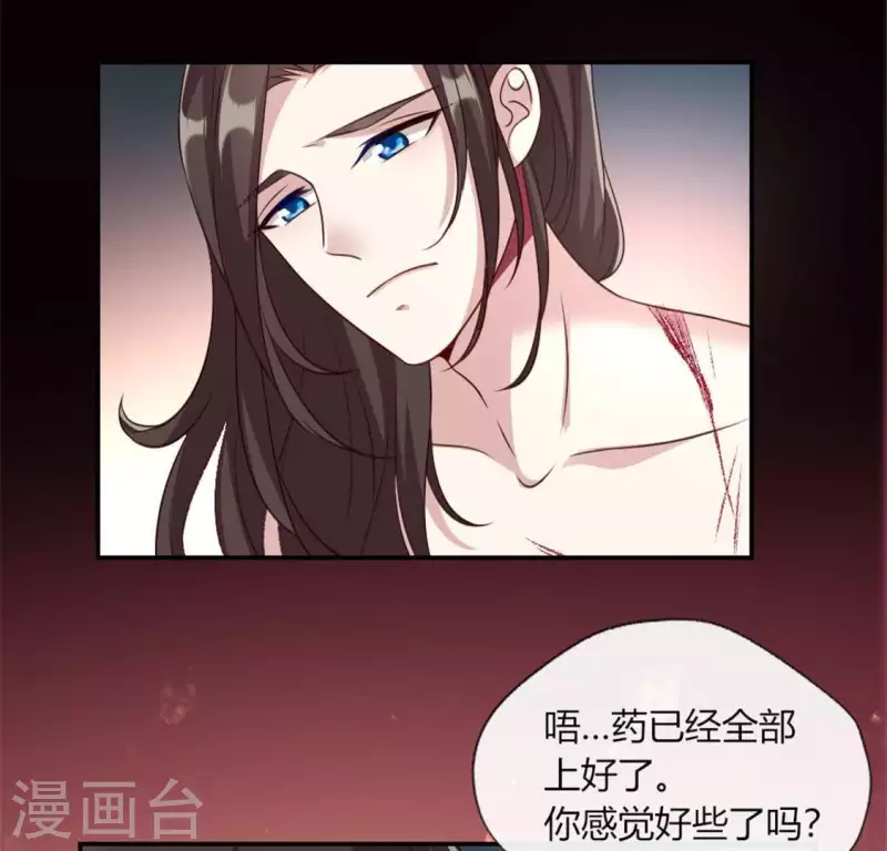 我的血族大人韩漫全集-第83话 伤痕无删减无遮挡章节图片 