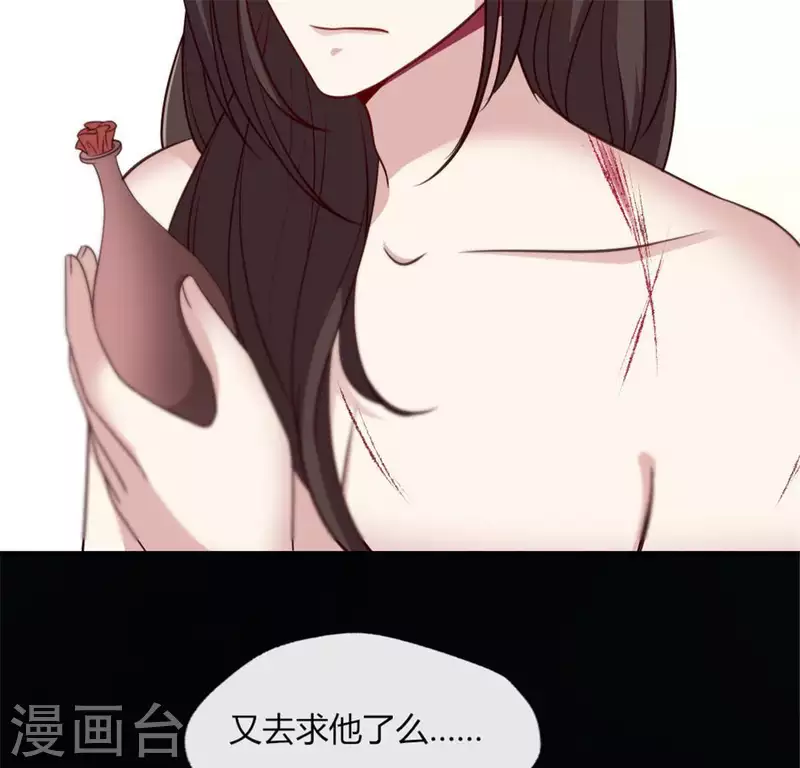我的血族大人韩漫全集-第83话 伤痕无删减无遮挡章节图片 
