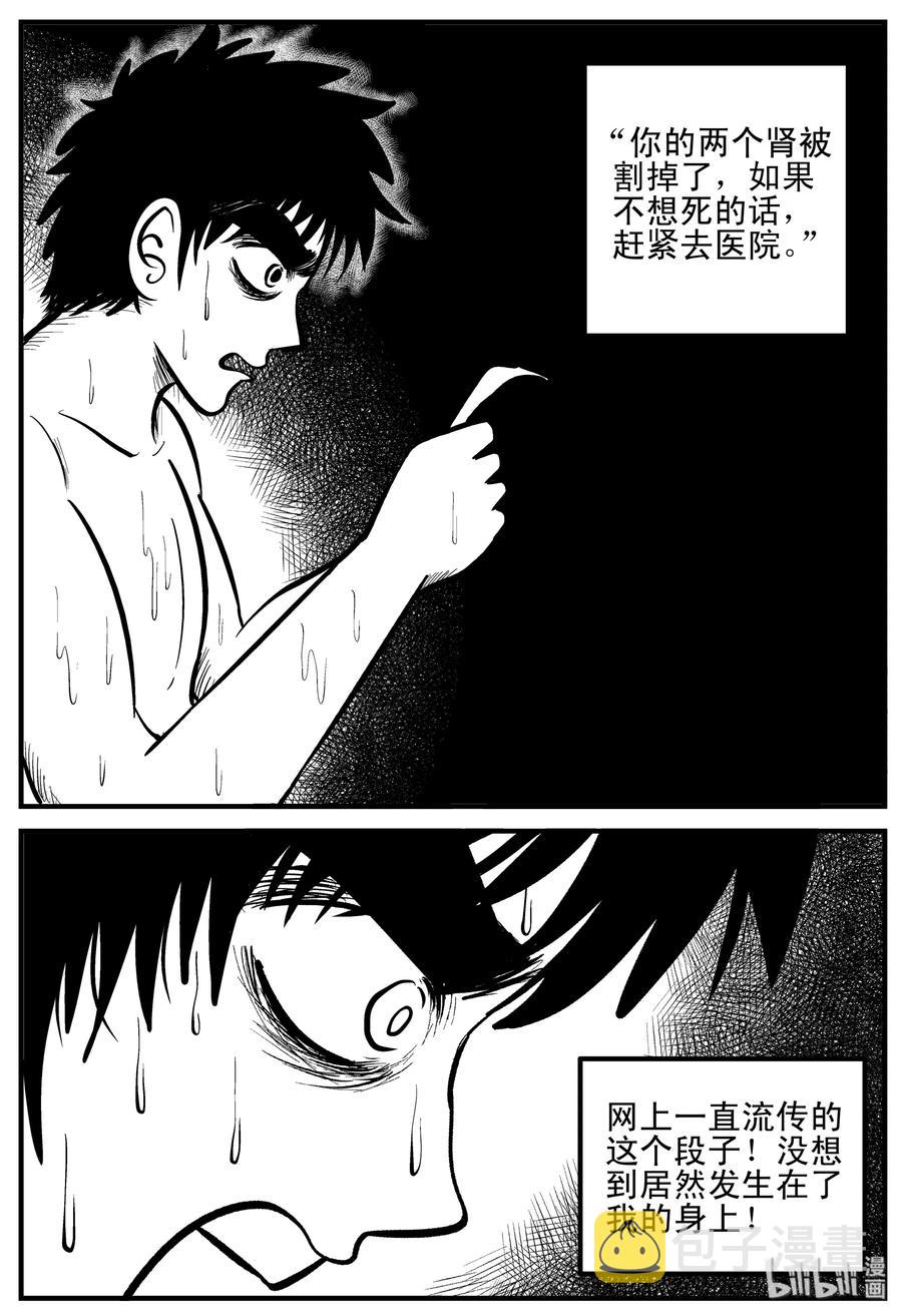 小智怪谈韩漫全集-205 谁偷了我的肾（1）无删减无遮挡章节图片 