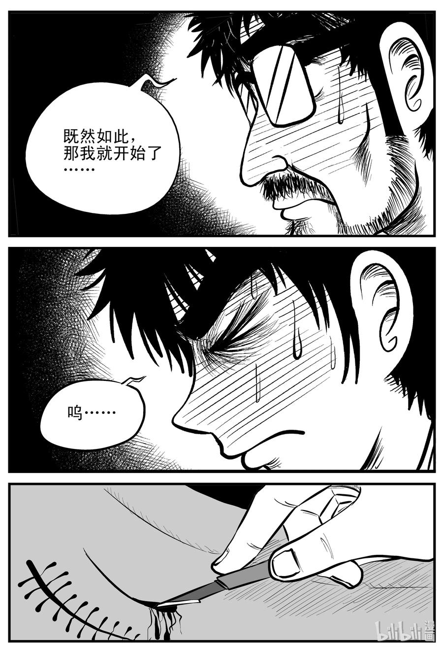 小智怪谈韩漫全集-206 谁偷了我的肾（2）无删减无遮挡章节图片 
