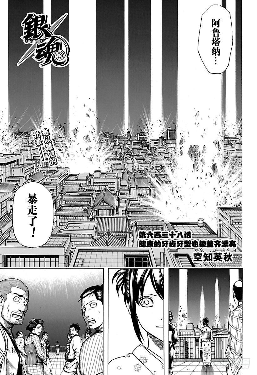 银魂韩漫全集-第638话 健康的牙齿牙型也很整无删减无遮挡章节图片 
